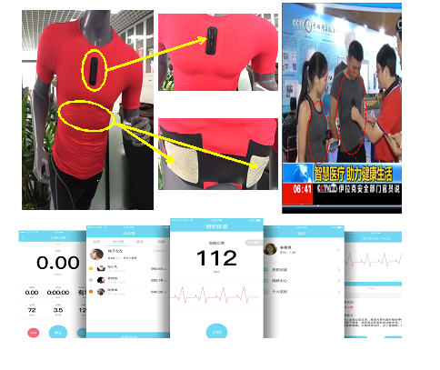 ECG-Monitoring Sport Shirt